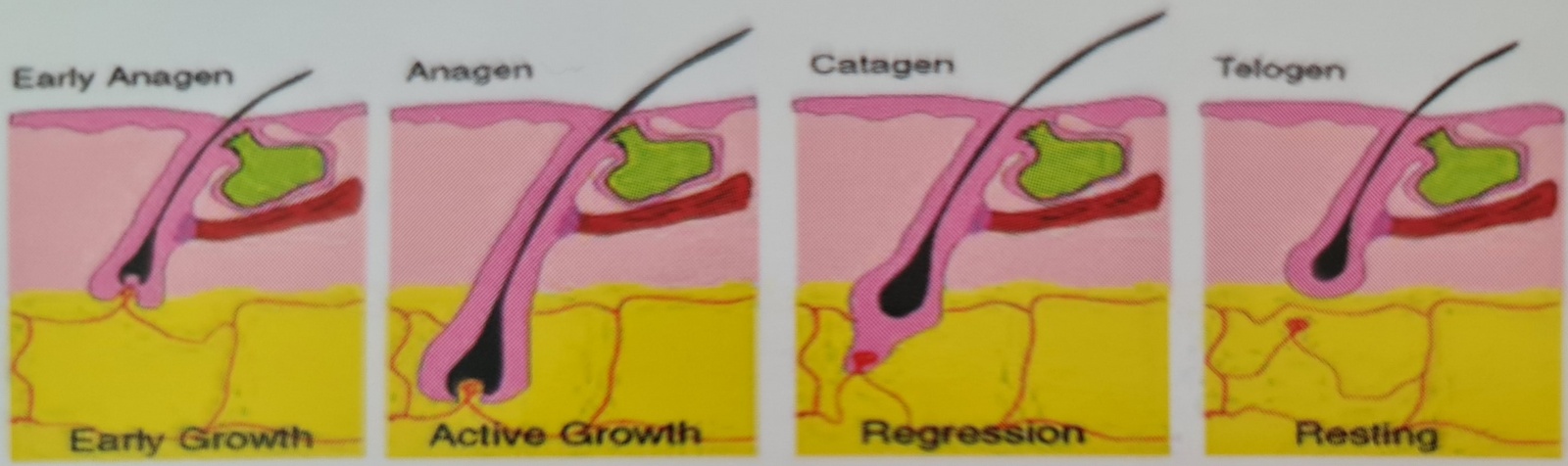 Haarentfernung Haarwachstum